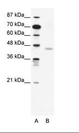 A: Marker, B: Jurkat Cell Lysate