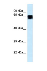 FAM161A antibody LS-C145454 Western blot of Placenta lysate. Antibody concentration 1 ug/ml.
