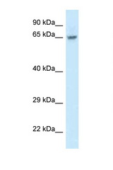 FAM161A antibody LS-C145455 Western blot of Jurkat Cell lysate. Antibody concentration 1 ug/ml.