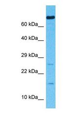 Western blot of F162A Antibody with human 786-0 Whole Cell lysate.