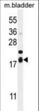 F162A Antibody western blot of mouse bladder tissue lysates (35 ug/lane). The F162A antibody detected the F162A protein (arrow).