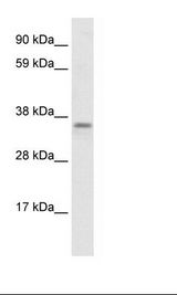 Fetal Brain Lysate