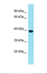 Western blot of Human Jurkat. FAM166A antibody dilution 1.0 ug/ml.