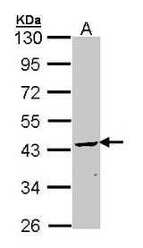 Sample (30 ug of whole cell lysate). A: Molt-4. 10% SDS PAGE. CNP antibody diluted at 1:1000.