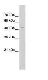 Jurkat Cell Lysate