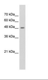 Jurkat Cell Lysate