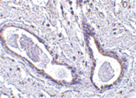 Immunohistochemistry of CCDC98 in human breast tissue with CCDC98 antibody at 5 ug/ml.