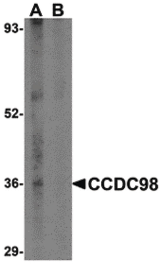 Western blot of CCDC98 in human breast tissue lysate in (A) the absence and (B) presence of blocking peptide with CCDC98 antibody at 1 ug/ml.