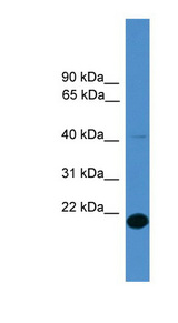 FAM176A / TMEM166 antibody LS-C116950 Western blot of 293T cell lysate.