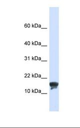 293T cell lysate. Antibody concentration: 1.0 ug/ml. Gel concentration: 10-20%.