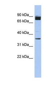 FAM190A antibody LS-C111776 Western blot of Fetal Heart lysate.