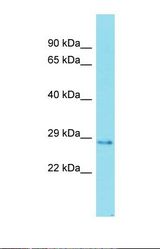 Western blot of Placenta. FAM192A antibody dilution 1.0 ug/ml.