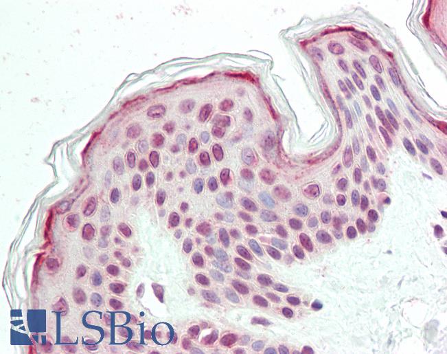 Anti-FAM193B antibody IHC staining of human skin. Immunohistochemistry of formalin-fixed, paraffin-embedded tissue after heat-induced antigen retrieval.