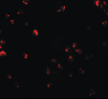 Immunofluorescence of FAM193B in Jurkat cells with FAM193B antibody at 20 ug/ml.