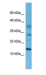 FAM19A4 antibody Western Blot of Rat Kidney.