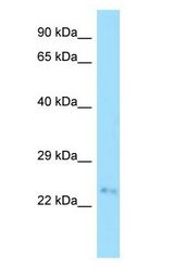 FAM207A antibody Western Blot of Fetal Small Intestine.