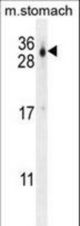 CU070 Antibody western blot of mouse stomach tissue lysates (35 ug/lane). The CU070 antibody detected the CU070 protein (arrow).