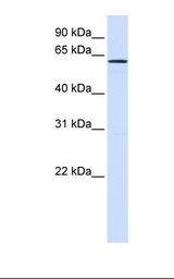 Fetal liver lysate. Antibody concentration: 1.0 ug/ml. Gel concentration: 12%.