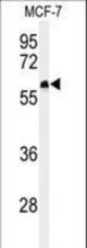 Western blot of FA20A Antibody in MCF-7 cell line lysates (35 ug/lane). FA20A (arrow) was detected using the purified antibody.