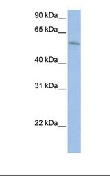 HepG2 cell lysate. Antibody concentration: 1.0 ug/ml. Gel concentration: 12%.