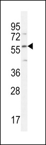 DMP4 Antibody western blot of HepG2 cell line lysates (35 ug/lane). The DMP4 antibody detected the DMP4 protein (arrow).
