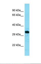 Western blot of Human Fetal Liver. FAM212A antibody dilution 1.0 ug/ml.