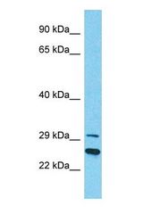 Western blot of FAM212B Antibody with human Placenta lysate.