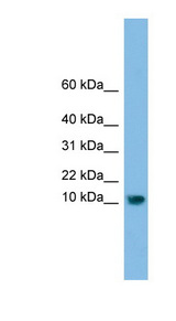 C13orf30 antibody LS-C116544 Western blot of MCF7 cell lysate.