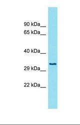 Western blot of Fetal Lung. FAM26E antibody dilution 1.0 ug/ml.