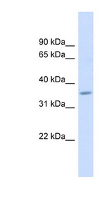 FAM26F antibody LS-C107947 Western blot of Fetal Muscle lysate.