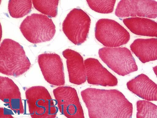Anti-FAM26F antibody IHC staining of human skeletal muscle. Immunohistochemistry of formalin-fixed, paraffin-embedded tissue after heat-induced antigen retrieval. Antibody LS-B11117 dilution 1:100.