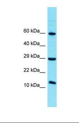 Western blot of Human HCT15. FAM32A antibody dilution 1.0 ug/ml.