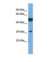 Western blot of Human PANC1. FAM3B antibody dilution 1.0 ug/ml.