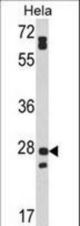 Western blot of FAM3B Antibody in HeLa cell line lysates (35 ug/lane). FAM3B (arrow) was detected using the purified antibody.