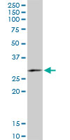 FAM3B monoclonal antibody (M07), clone 1E7. Western blot of FAM3B expression in human kidney.