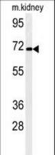 Western blot of FA40B Antibody in mouse kidney tissue lysates (35 ug/lane). FA40B (arrow) was detected using the purified antibody.