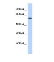 Western blot of Human HepG2. FAM46A antibody dilution 1.0 ug/ml.