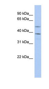 FAM46A antibody LS-C110694 Western blot of PANC1 cell lysate.
