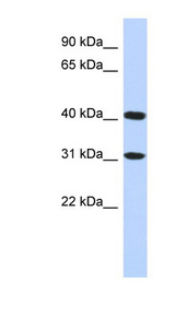 FAM46D antibody LS-C102515 Western blot of HepG2 cell lysate.
