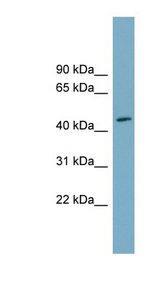 FAM53C antibody LS-C111954 Western blot of Fetal Small Intestine lysate.