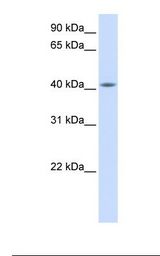Fetal muscle lysate. Antibody concentration: 1.0 ug/ml. Gel concentration: 12%.