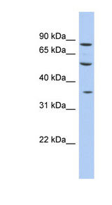 FAM63A antibody LS-C111867 Western blot of Fetal liver lysate.