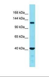 Western blot of Placenta. FAM65A antibody dilution 1.0 ug/ml.