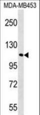 FAM65B Antibody western blot of MDA-MB453 cell line lysates (35 ug/lane). The FAM65B antibody detected the FAM65B protein (arrow).