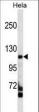 FAM65C Antibody western blot of HeLa cell line lysates (35 ug/lane). The FAM65C antibody detected the FAM65C protein (arrow).