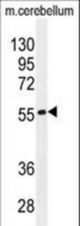 FAM69B Antibody western blot of mouse cerebellum tissue lysates (35 ug/lane). The FAM69B antibody detected the FAM69B protein (arrow).