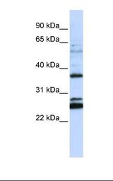 Jurkat cell lysate. Antibody concentration: 1.0 ug/ml. Gel concentration: 12%.