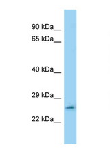 FAM71C antibody LS-C146423 Western blot of Jurkat Cell lysate. Antibody concentration 1 ug/ml.