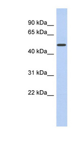 FAM71D antibody LS-C110612 Western blot of Fetal Kidney lysate.