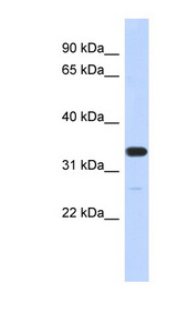 FAM76A antibody LS-C102516 Western blot of MCF7 cell lysate.
